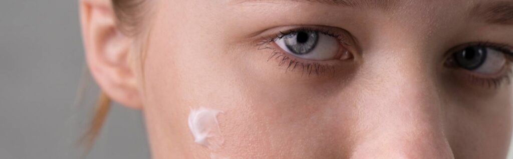 Mejores cremas para el acné