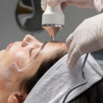 Tratamientos de estética más rentables [Top 5]